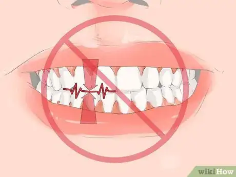 Image titled Identify if You Have Sensitive Teeth Step 14