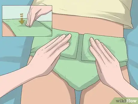 Image titled Change a Cloth Adult Diaper Step 18