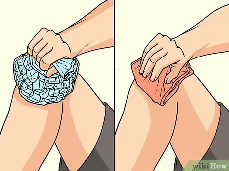 Image titled Cure Bone Pain Step 9