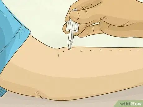 Image titled Get Tested for Allergies Step 5