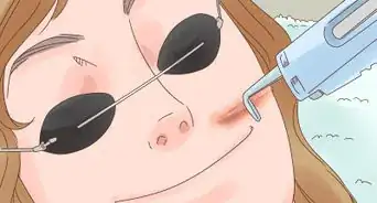 Hide Keloid Scars with Makeup