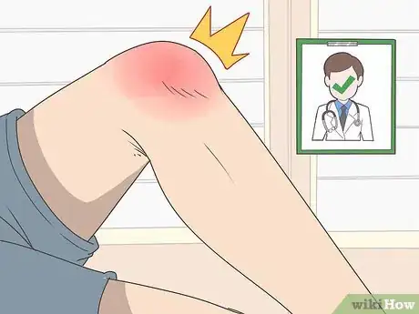 Image titled Repair Knee Ligament Damage Step 1