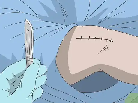 Image titled Treat Rheumatism Step 7