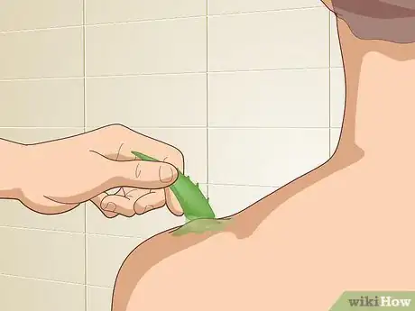 Image titled Reduce Scars Naturally Step 4