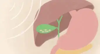 Relieve Biliary Colic Pain