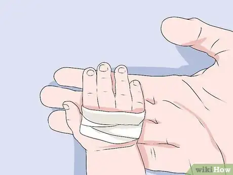 Image titled Treat Burns in Infants Step 5