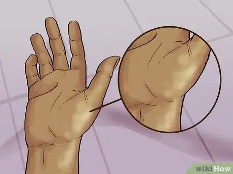 Image titled Care for a Tattoo During Removal Step 4