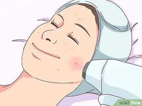 Image titled Reduce the Appearance of Old Scars Step 9