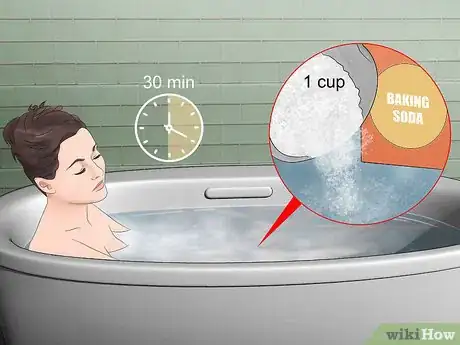 Image titled Treat Sand Flea Bites Step 4