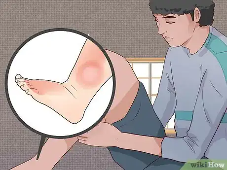 Image titled Recognize Symptoms of Heart Failure Exacerbation Step 10