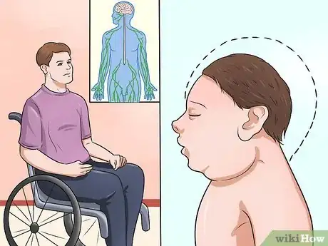 Image titled Recognize Zika Step 5