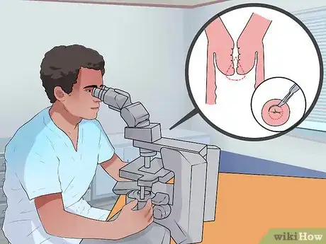 Image titled Treat Cervical Cancer Step 2