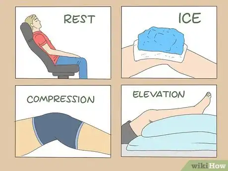 Image titled Repair Knee Ligament Damage Step 4