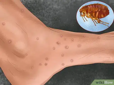 Image titled Identify Canine Flea Problems Step 6