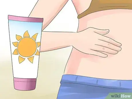 Image titled Reduce the Appearance of Stretch Marks Step 6