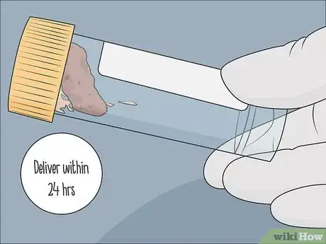 Image titled Store a Stool Sample Step 12