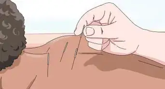 Alleviate Hot Flashes