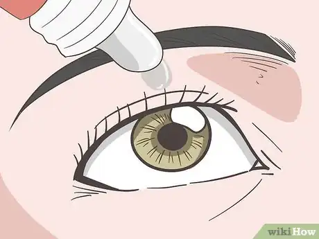 Image titled Manage Eye Disorders with Crohn's Disease Step 4