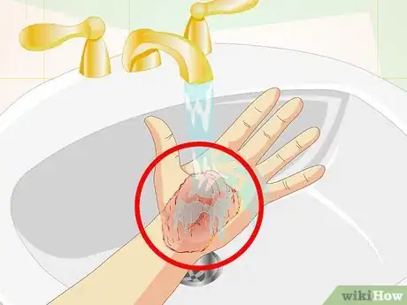 Image titled Care for Superficial Wounds Step 7