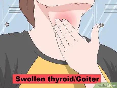 Image titled Recognize the Signs of Graves' Disease Step 5