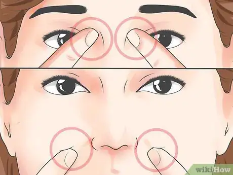 Image titled Distinguish Sinusitis from Similar Conditions Step 7
