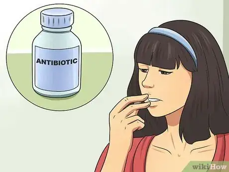 Image titled Cope with an Ulcer Step 2