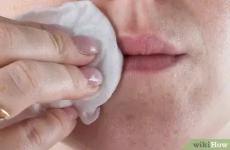 Image titled Get Red Lipstick Off Your Lips Step 7