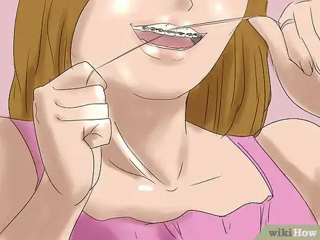 Image titled Make Out With Braces Step 13