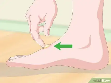 Image titled Detect Flea Bites Step 4