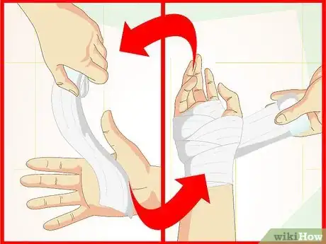 Image titled Care for Superficial Wounds Step 6