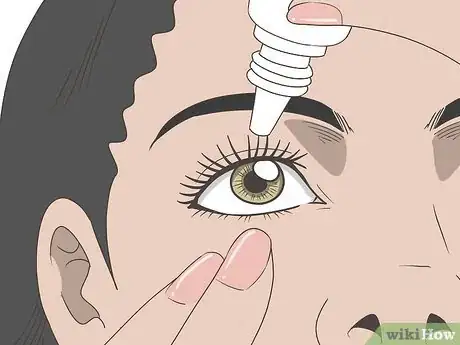 Image titled Treat Eye Sunburn Step 14