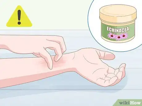 Image titled Use Herbs to Heal Step 19