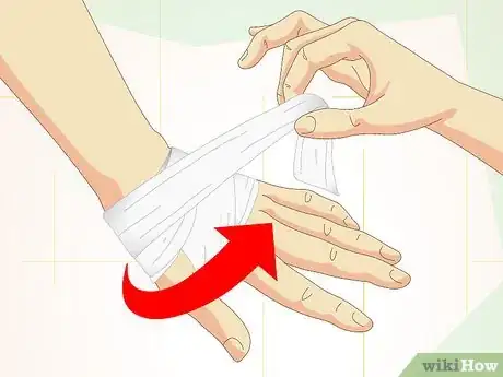 Image titled Care for Superficial Wounds Step 5