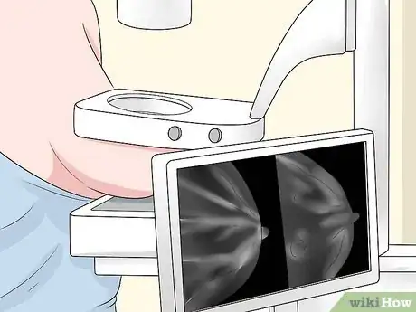 Image titled Check Lymph Nodes Step 12