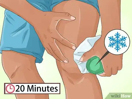 Image titled Treat Anterior Cruciate Ligament (ACL) Tears Step 2