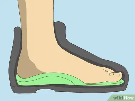 Image titled Freeze Plantar Warts Step 12