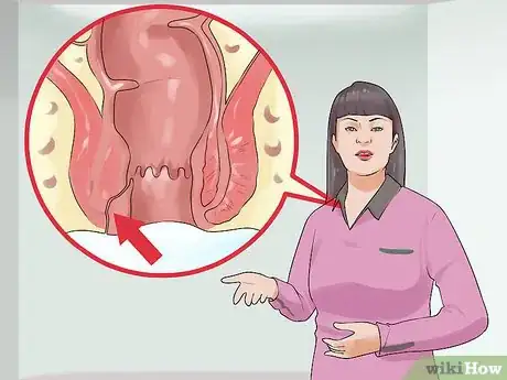 Image titled Explain Crohn's Disease to Others Step 4