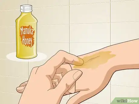 Image titled Reduce Scars Naturally Step 6