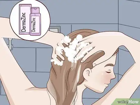 Image titled Get Rid of Dandruff at Home Step 1