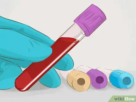 Image titled Diagnose Liver Cancer Step 9