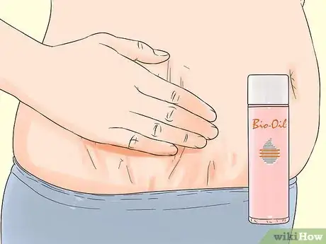 Image titled Use Bio Oil Step 1