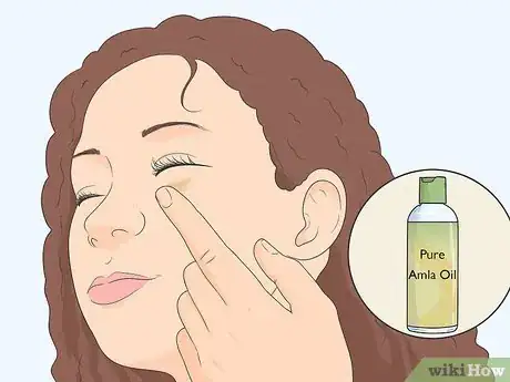 Image titled Treat Under Eye Wrinkles Step 8