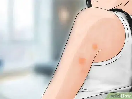 Image titled Avoid Bed Bugs when Traveling Step 13