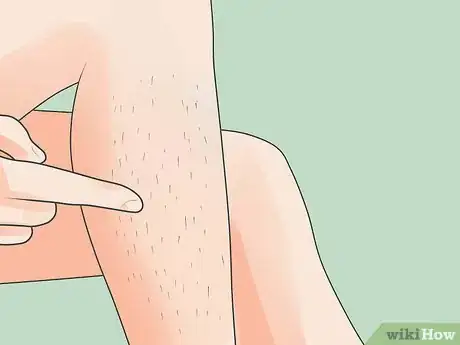 Image titled Epilate Legs Step 14