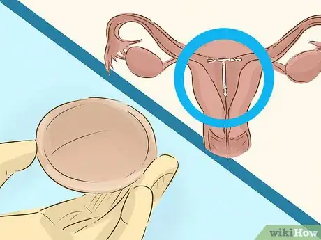 Image titled Have a Healthy Sex Life (Teens) Step 6