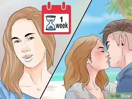 Image titled Be Happy with Braces Step 2