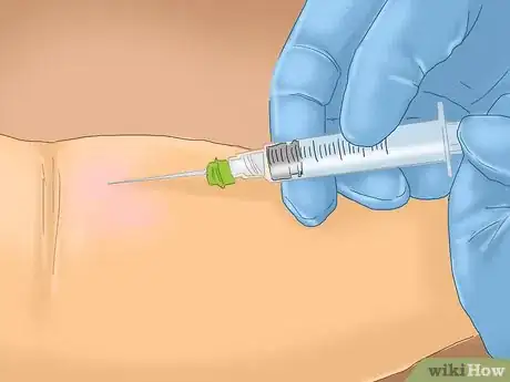 Image titled Prevent Thyroid Cancer Step 3