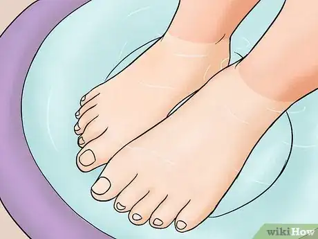 Image titled Get Rid of Peeling Skin Step 1