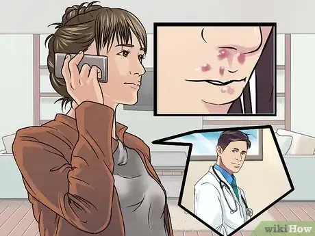 Image titled Treat Cold Sores in Your Nose Step 14