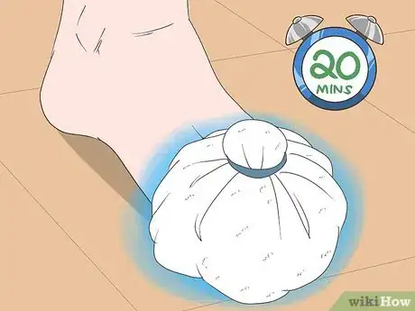 Image titled Heal a Bruised Toe Step 1
